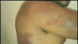 Bahamas iniciará procedimientos legales a militares implicados en abusos a cubanos Bahamas iniciará procedimientos legales a militares implicados en abusos a cubanos