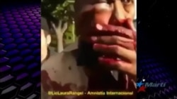 Cuerpos de seguridad de Venezuela disparan bomba lacrimógena contra anciano Cuerpos de seguridad de Venezuela disparan bomba lacrimógena contra anciano