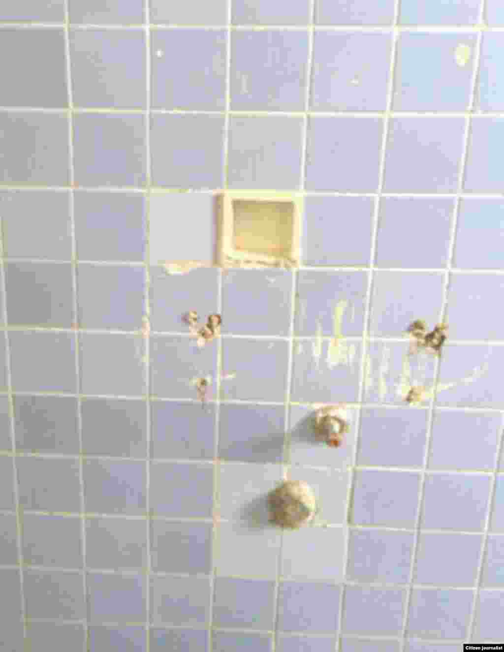 Instalaciones sanitarias en Hospital Celia Sánchez, Campechuela, según reporta Rudi Batista.